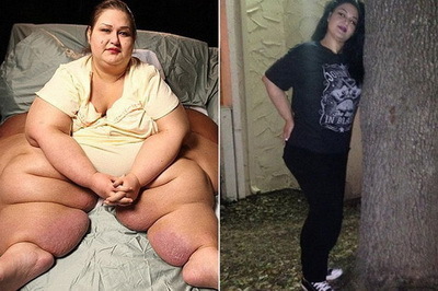 Найтовстіша у світі жінка схудла на 408 кг