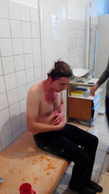 В Житомирской области избили депутата, боровшегося с янтарной мафией