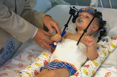 Врачи спасли малыша, которому в ДТП оторвало голову