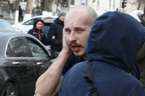 В Херсоне депутат "Оппозиционного блока" откусил ухо активисту "Азова"