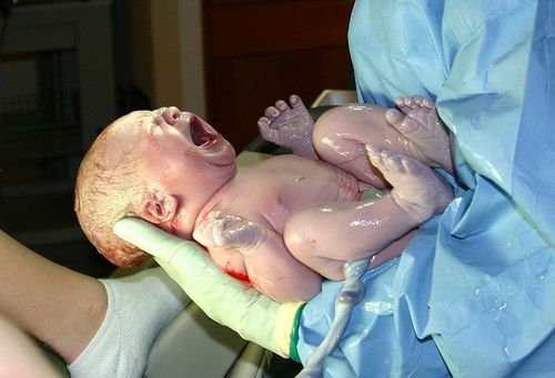 В Польше ребенок родился через 55 дней после смерти своей матери
