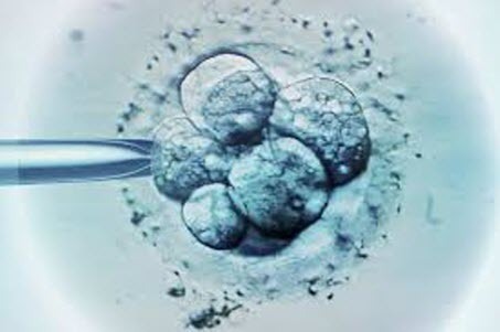 В Нидерландах разрешили выращивать человеческие эмбрионы для исследований