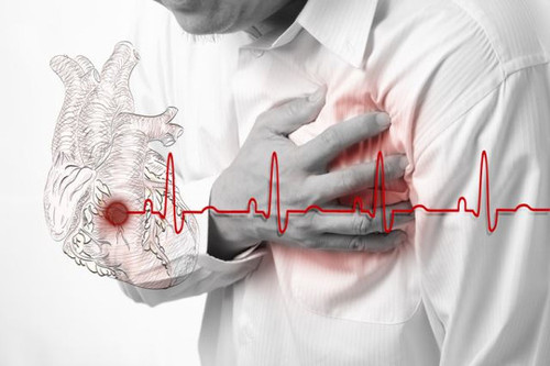 Как быстро распознать инфаркт и спасти сердце