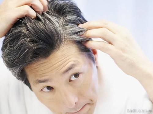 Основные причины появления седых волос
