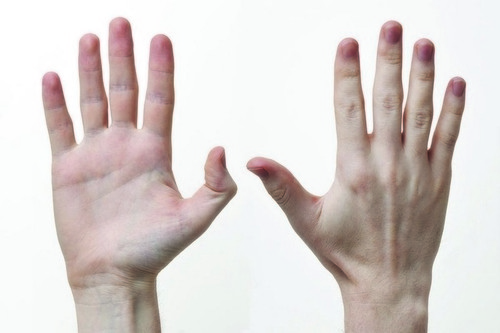 Что могут рассказать о вас пальцы рук