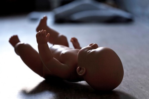 В Житомирской области женщина и нерожденный ребенок умерли во время родов