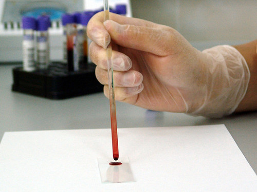 Экспертам WADA не дали вывезти пробы из Московской антидопинговой лаборатории