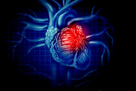 Что нужно знать о сердечном приступе