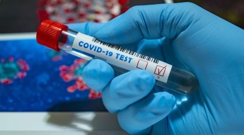 В России установлен новый рекорд по количеству заразившихся коронавирусом