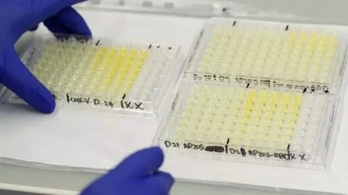 Израильские ученые выявили антитело, нейтрализующее коронавирус