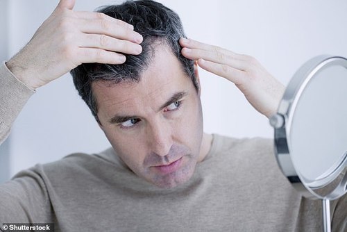 Почти четверть пациентов с Covid сталкиваются с выпадением волос через полгода после болезни