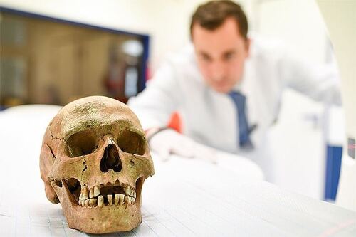 Ученые научились определять причину смерти по зубам