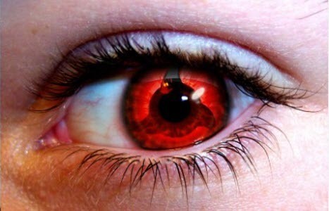 Причины появления красных глаз