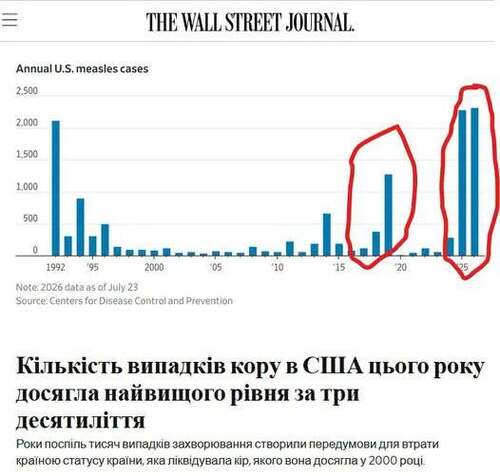 "Кількість випадків кору в США досягла 30-річного максимуму на тлі зниження рівня вакцинації" - Юрій Ніколов