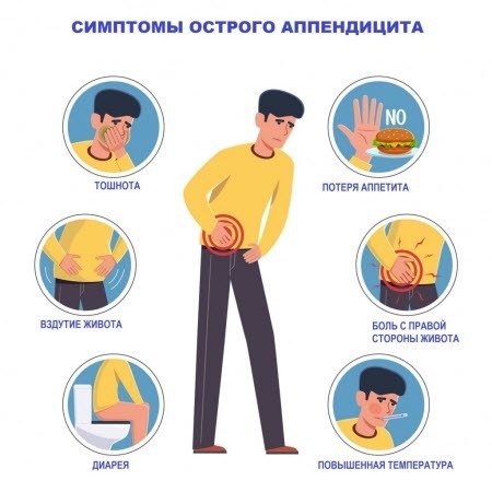 Как вовремя распознать аппендицит